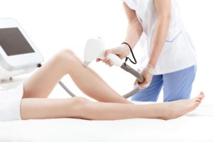 Women Laser Hair Removal